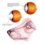 HAHD_NuclearSclerosis_Cataract